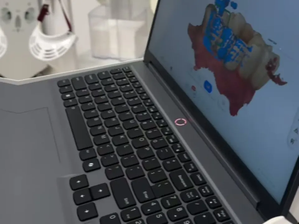 Arcadă dentară scanată, afișată în 3D pe ecranul unui laptop, în clinică.